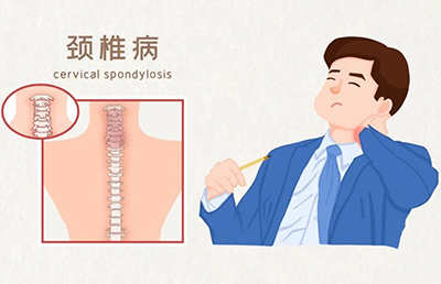 警惕！骨與關(guān)節(jié)的“健康危機(jī)”，你中招了嗎？